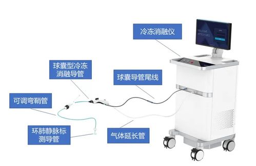 冷量可调 复温提醒,上海又一自主研发冷冻消融创新产品获批上市